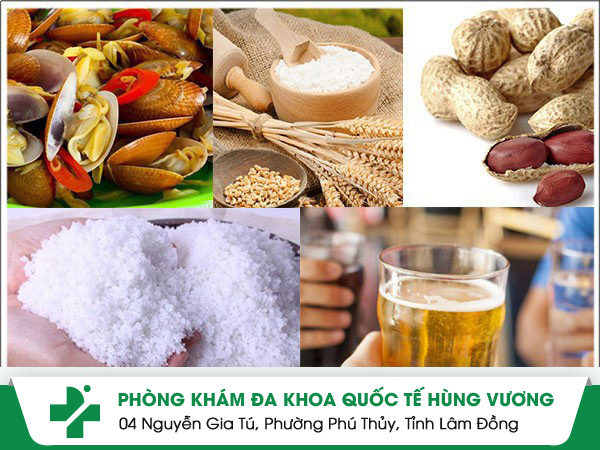 Bệnh chàm nên kiêng ăn gì?