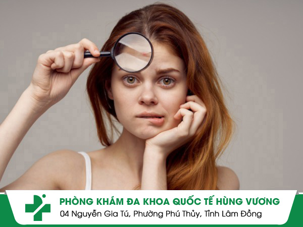 Chữa bệnh ngoài da ở đâu hiệu quả?