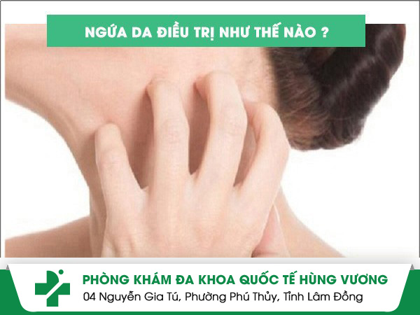 Cách điều trị ngứa da hiệu quả, nhanh chóng tại TP.HCM