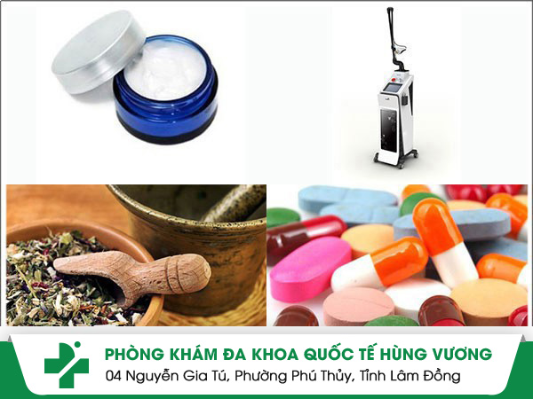 Cách trị lang ben bằng phương pháp LBS hiện đại