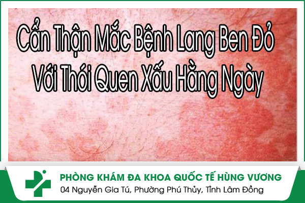 Bệnh Lang Ben Đỏ Có Nguy Hiểm Không?
