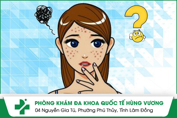 Cảnh Báo Không Nên Xem Nhẹ Các Nốt Mụn Nước Trên Mặt