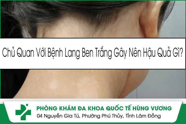 Lang Ben – Cảnh Báo Đừng Xem Nhẹ Những Đốm Trắng Trên Da!