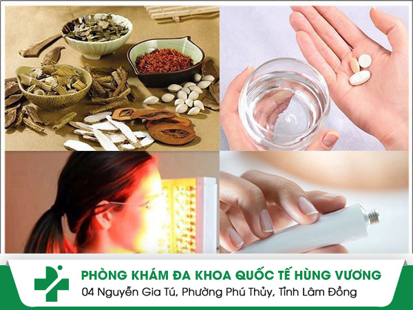 Bí quyết chữa mụn ngứa nhanh khỏi không để lại sẹo xấu