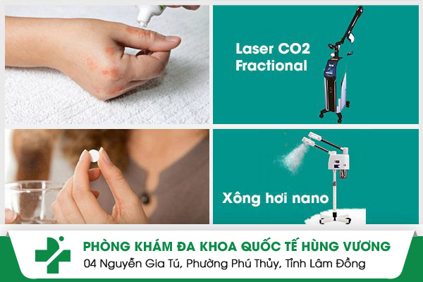 Bị Kiến Ba Khoang Cắn – Dấu Hiệu Nhận Biết & Cách Điều Trị Hiệu Quả, Không Để Lại Sẹo