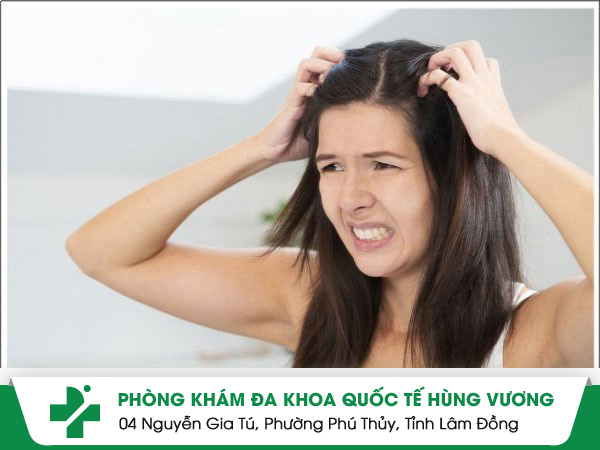 Da đầu bị ngứa đi tìm nguyên nhân và cách ngăn chặn nhanh hiệu quả