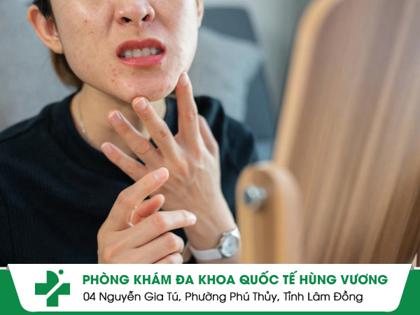 Da Bị Sần Sùi Và Ngứa: Nguyên Nhân & Cách Nhận Biết Sớm Các Bệnh Da Liễu