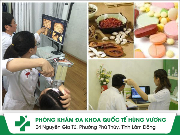 Đánh bay gàu ngứa chỉ sau 1 liệu trình