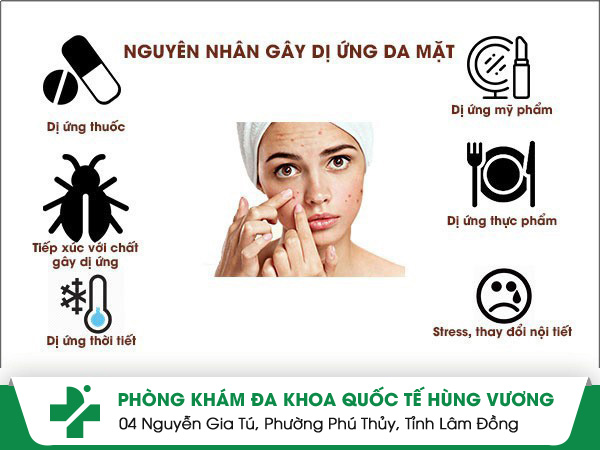Truy tìm nguyên nhân dị ứng da mặt và cách điều trị hiệu quả