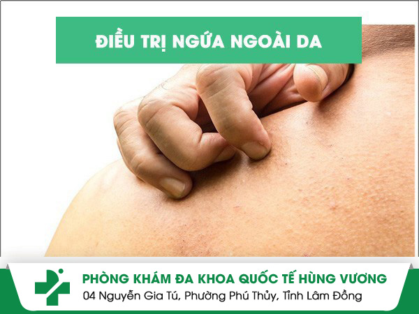 Điều trị ngứa ngoài da như thế nào hiệu quả?
