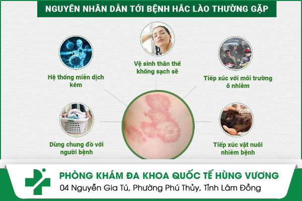 hắc lào vùng kín