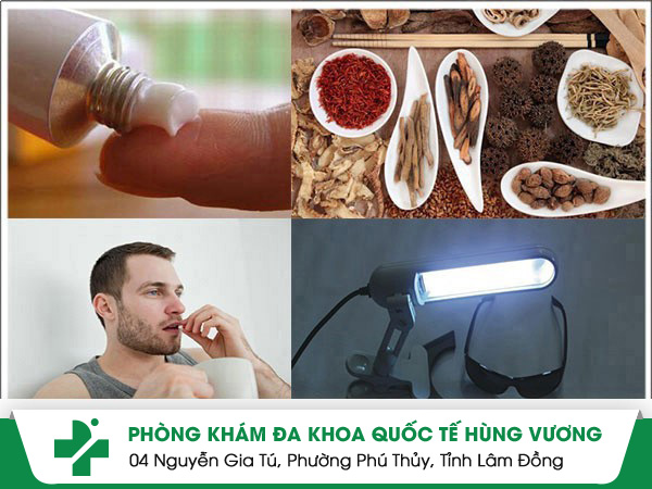 Nấm bẹn ở nam giới có lây không?