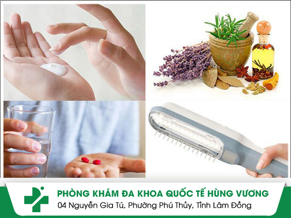 Nguyên nhân gây nấm da đùi và cách điều trị hiệu quả bất ngờ