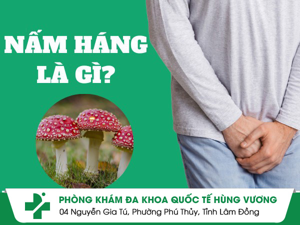 Những thông tin về bệnh nấm háng mà bạn cần biết