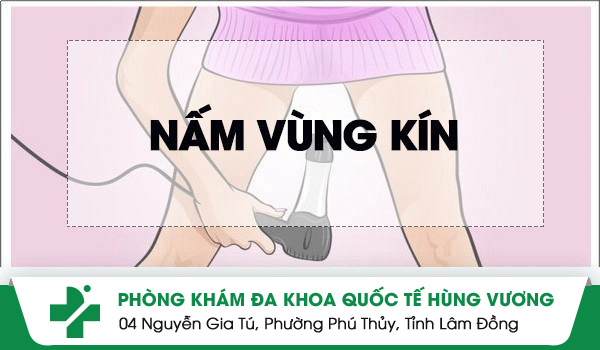 Nấm ở vùng kín hết sức nguy hiểm không nên xem thường