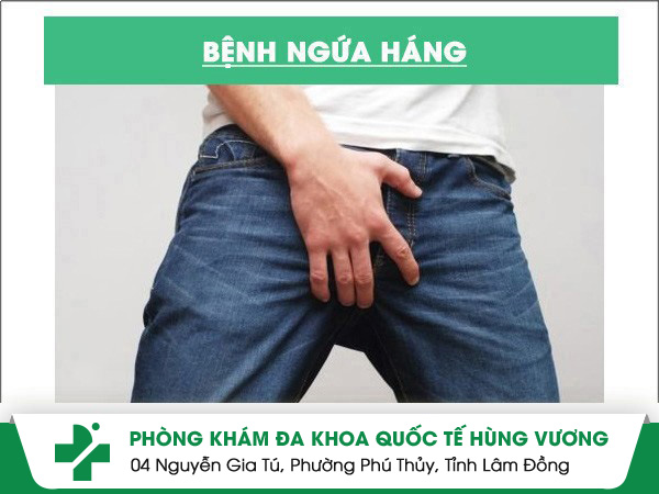 Ngứa háng là triệu chứng của bệnh gì?