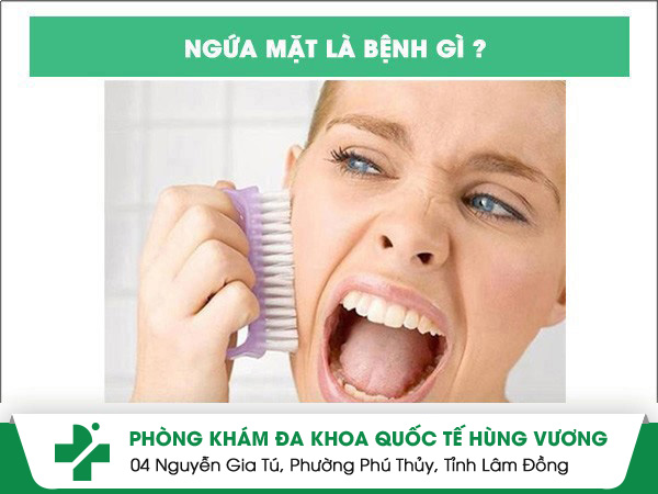 Ngứa mặt là bị bệnh gì? ngứa mặt
