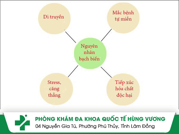 Nguyên nhân bạch biến và cách điều trị hiệu quả không lo tái bệnh
