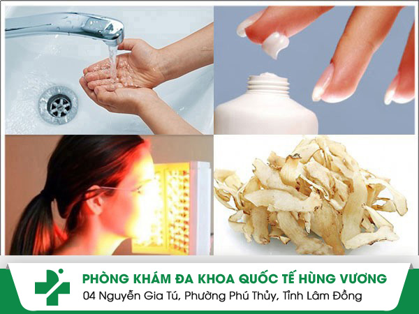 Phải làm gì khi da bị dị ứng để tránh thâm sẹo?