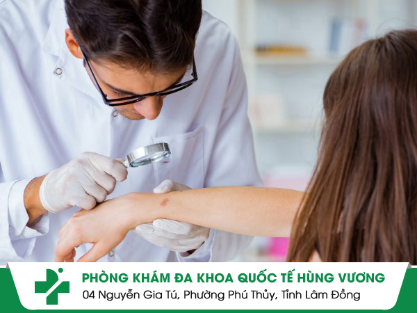 Điều trị bệnh da liễu ở phòng khám da liễu Quận Phú Nhuận nào là an toàn?