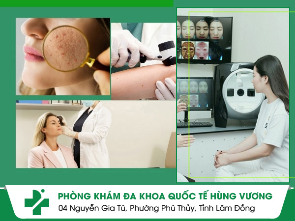Phòng khám da liễu huyện Củ Chi nào tốt và uy tín?