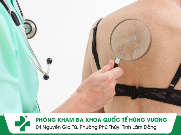 Điều trị hiệu quả bệnh da liễu tại phòng khám da liễu Quận 4 nào?