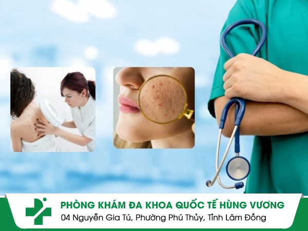 Địa chỉ phòng khám da liễu Quận 5 uy tín và hiệu quả