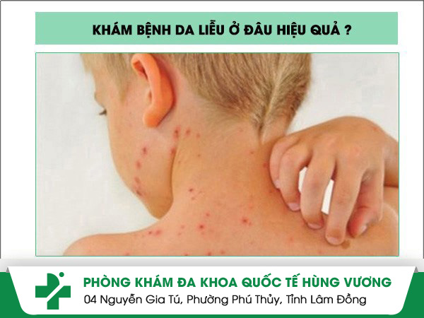 Phòng Khám Da Liễu Quận Tân Phú – Nơi Gửi Gắm Niềm Tin Cho Làn Da Khỏe Mạnh