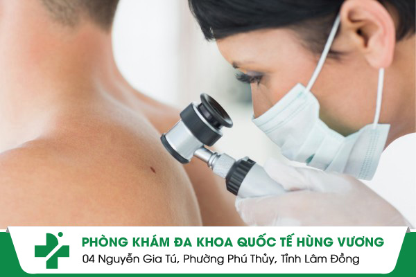 Phòng Khám Da Liễu Thủ Đức Uy Tín – Khám Nhanh, Điều Trị Hiệu Quả