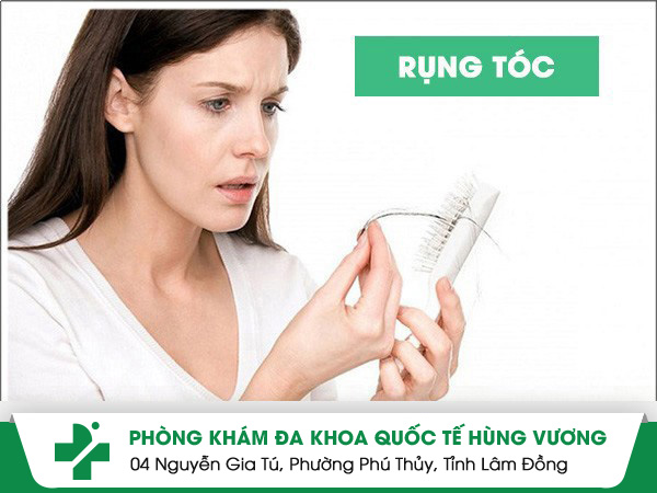Rụng tóc mối lo nhức nhối của nhiều người
