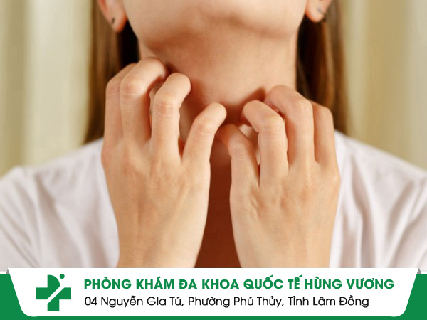 Các yếu tố dẫn đến tình trạng sẩn ngứa