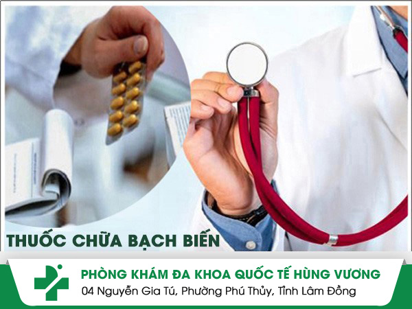 Thuốc chữa bạch biến loại nào tốt?