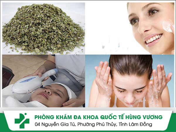 Cách trị dị ứng da mặt an toàn từ chuyên gia hàng đầu