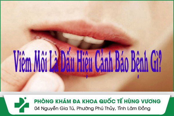 Viêm Môi Là Dấu Hiệu Cảnh Báo Bệnh Gì?