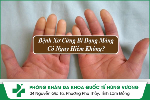 Bệnh Xơ Cứng Bì Dạng Mảng Có Nguy Hiểm Không?